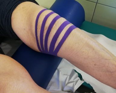 Kolano seniorki oklejone taśmami kinezjologicznymi działającymi przeciwobrzękowo