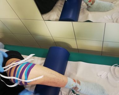 Kolano seniorki oklejone taśmami kinezjologicznymi działającymi przeciwobrzękowo