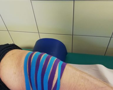 Kolano seniorki oklejone taśmami kinezjologicznymi działającymi przeciwobrzękowo
